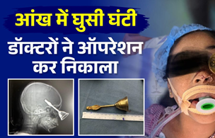 आंख से दिमाग में घुस गई घंटी, डॉक्टरों ने ऑपरेशन कर सफलतापूर्वक निकाली