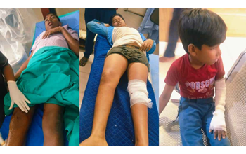 नशे में ई-रिक्शा चालक के अनियंत्रित होने से पलटी, पांच स्कूली बच्चे घायल